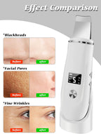 Ultrasonic Facial Skin Scrubber and Pore Cleansing Spatula