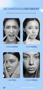 Cryo Facial Ice Roller for Skin Tightening and Puffiness