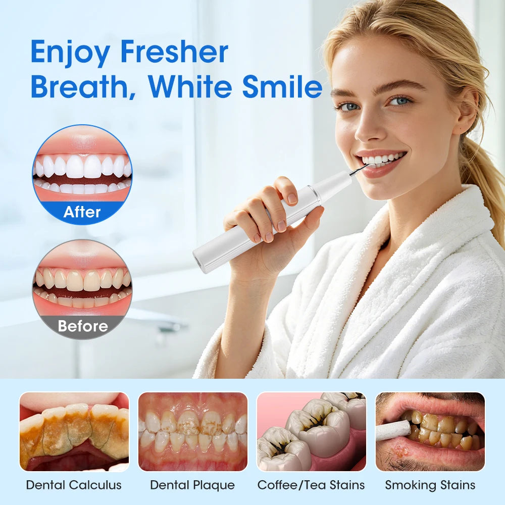 Ultrasonic Electric Teeth Cleaning Plaque Remover Kit