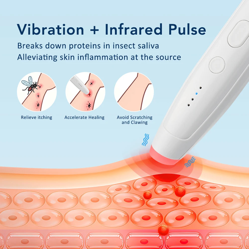 Electric Itch Relief Pen for Insect Bites