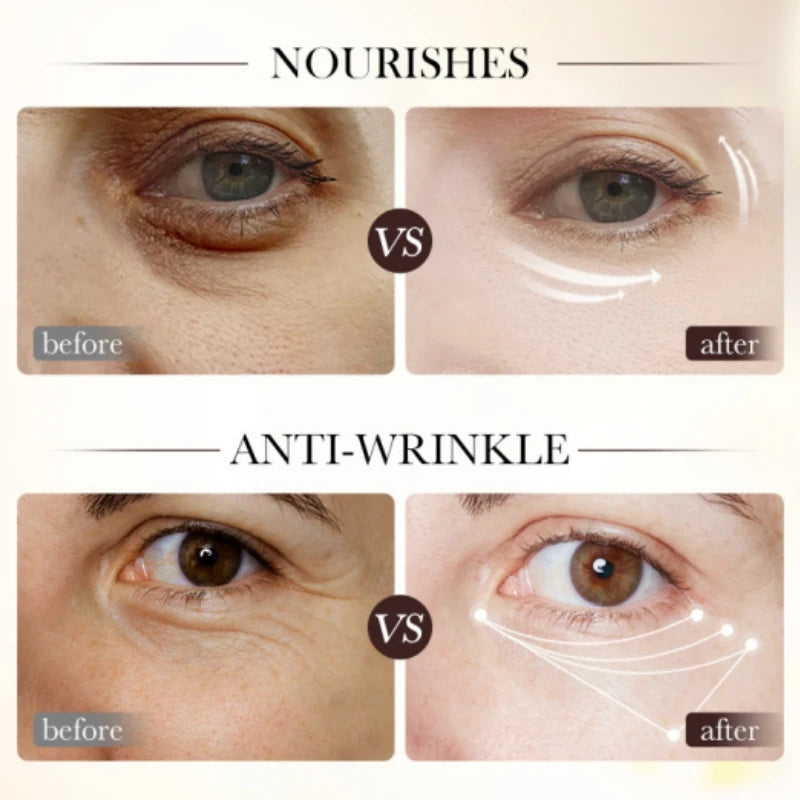 Retinol Anti-Wrinkle Firming Eye Serum for Dark Circles and Puffiness