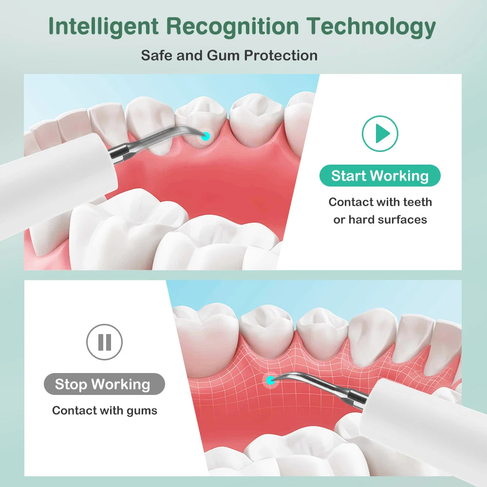 Ultrasonic Teeth Tartar and Plaque Remover
