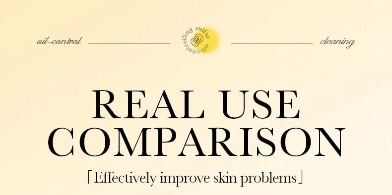 Sulfur Anti-Acne and Mite Removing Facial Soap - 13