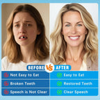 Instant Snap-On Cosmetic Dentures with Storage Case