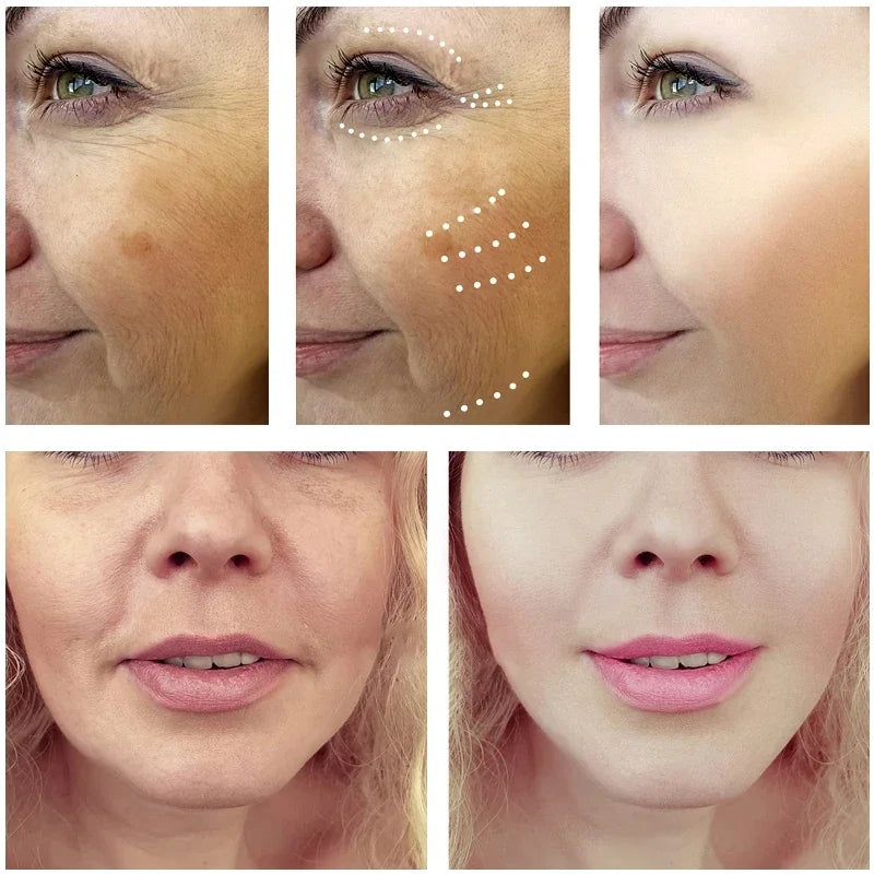 Anti-Aging Dragon Blood Facial Rejuvenation Serum