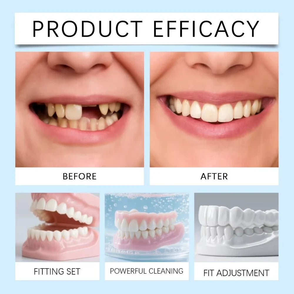 Temporary Snap-On Cosmetic Dentures for Instant Smile Restoration