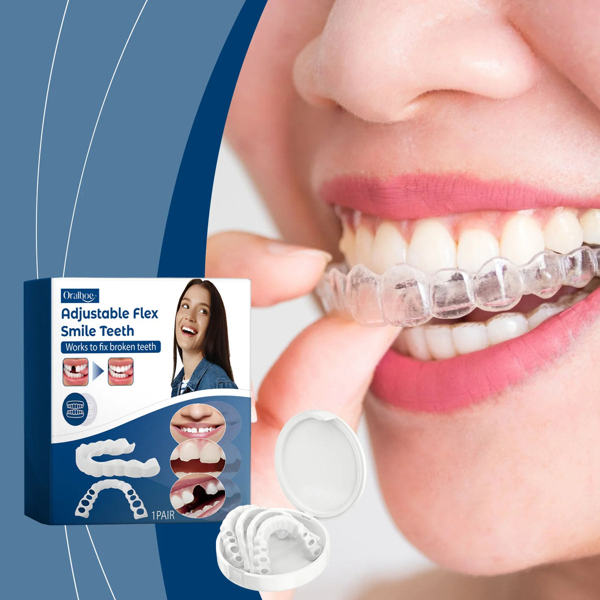 Adjustable Snap-On Cosmetic Dentures for Instant Perfect Smile