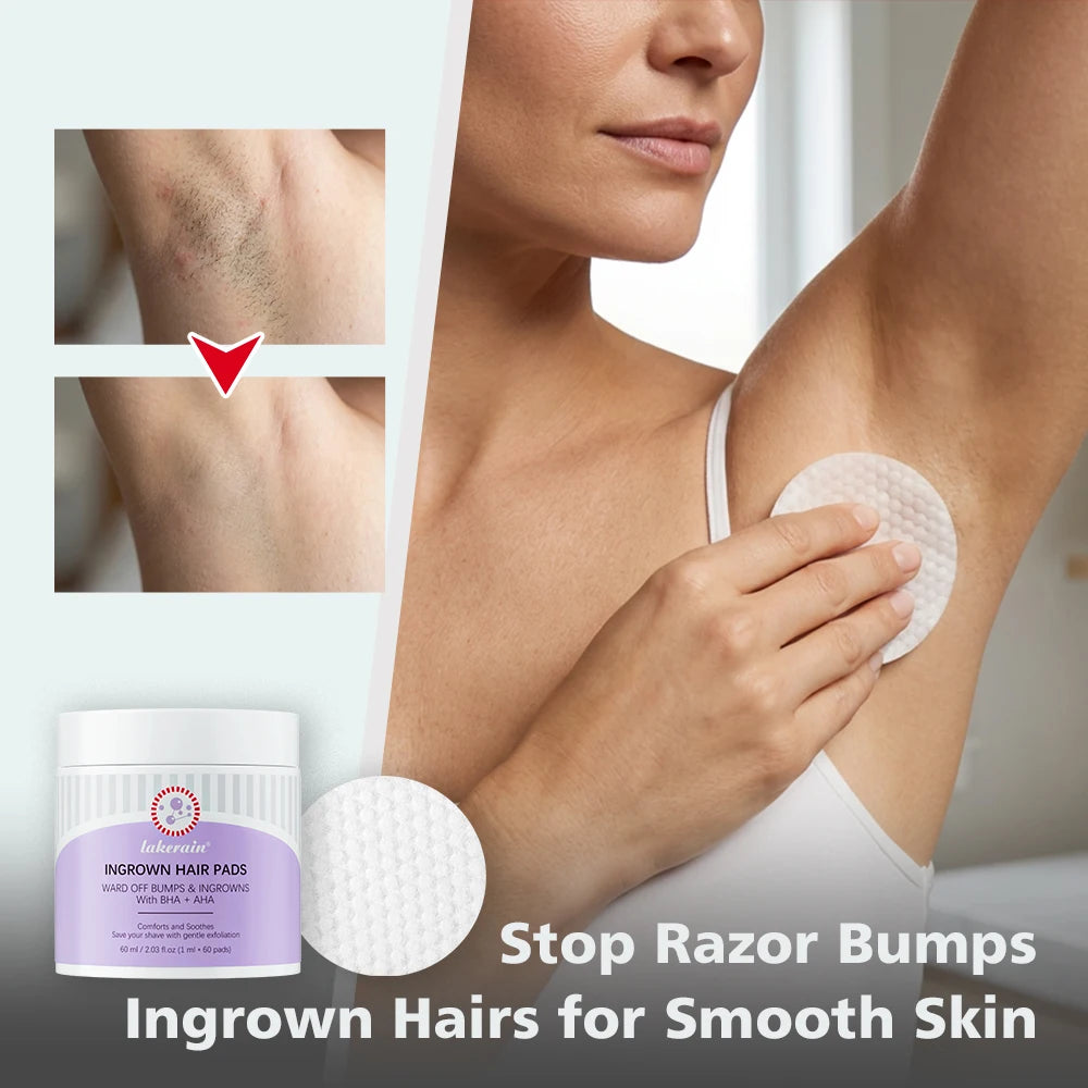 Exfoliating Ingrown Hair and Razor Bump Treatment Pads
