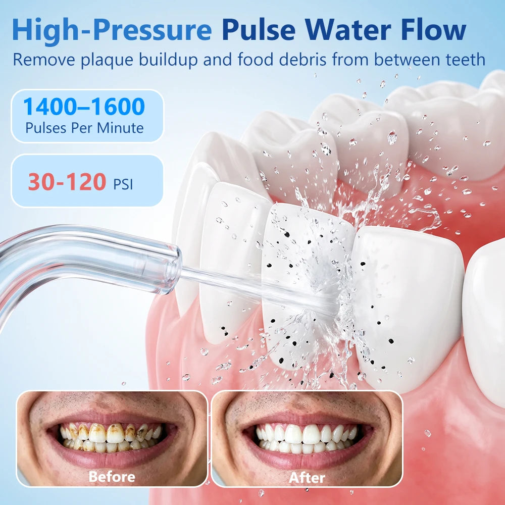 Cordless Portable Water Dental Flosser for Teeth and Braces