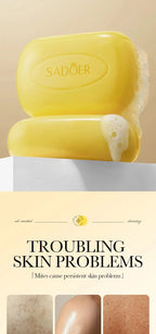 Sulfur Anti-Acne and Mite Removing Facial Soap