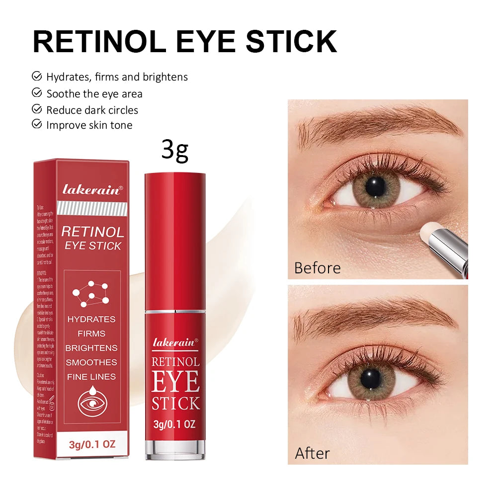 Anti-Aging Retinol Eye Stick for Dark Circles and Fine Lines