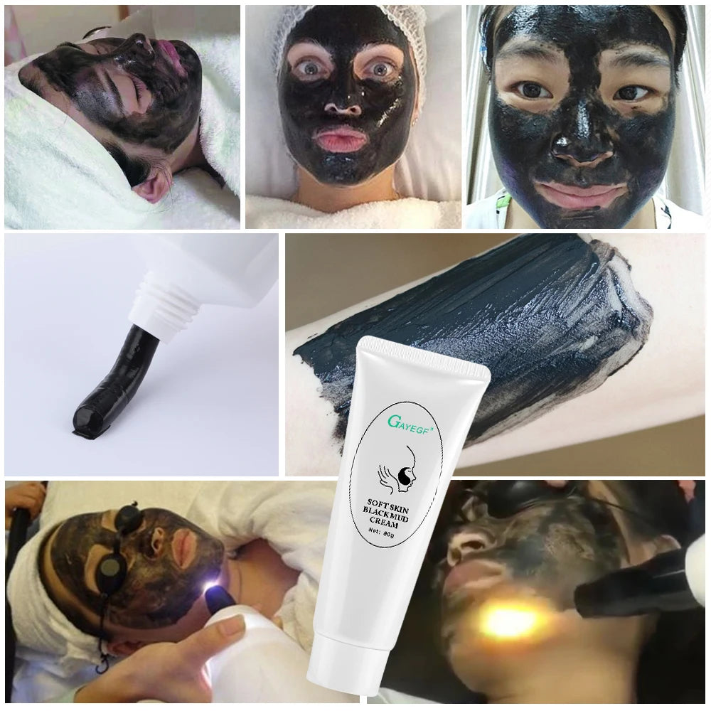 Carbon Laser Facial Gel for Pore Cleansing and Skin Rejuvenation - 8