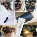 Carbon Laser Facial Gel for Pore Cleansing and Skin Rejuvenation