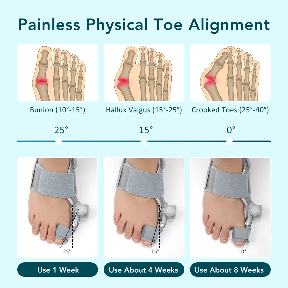 Adjustable Bunion Corrector for Pain Relief and Toe Alignment - 15