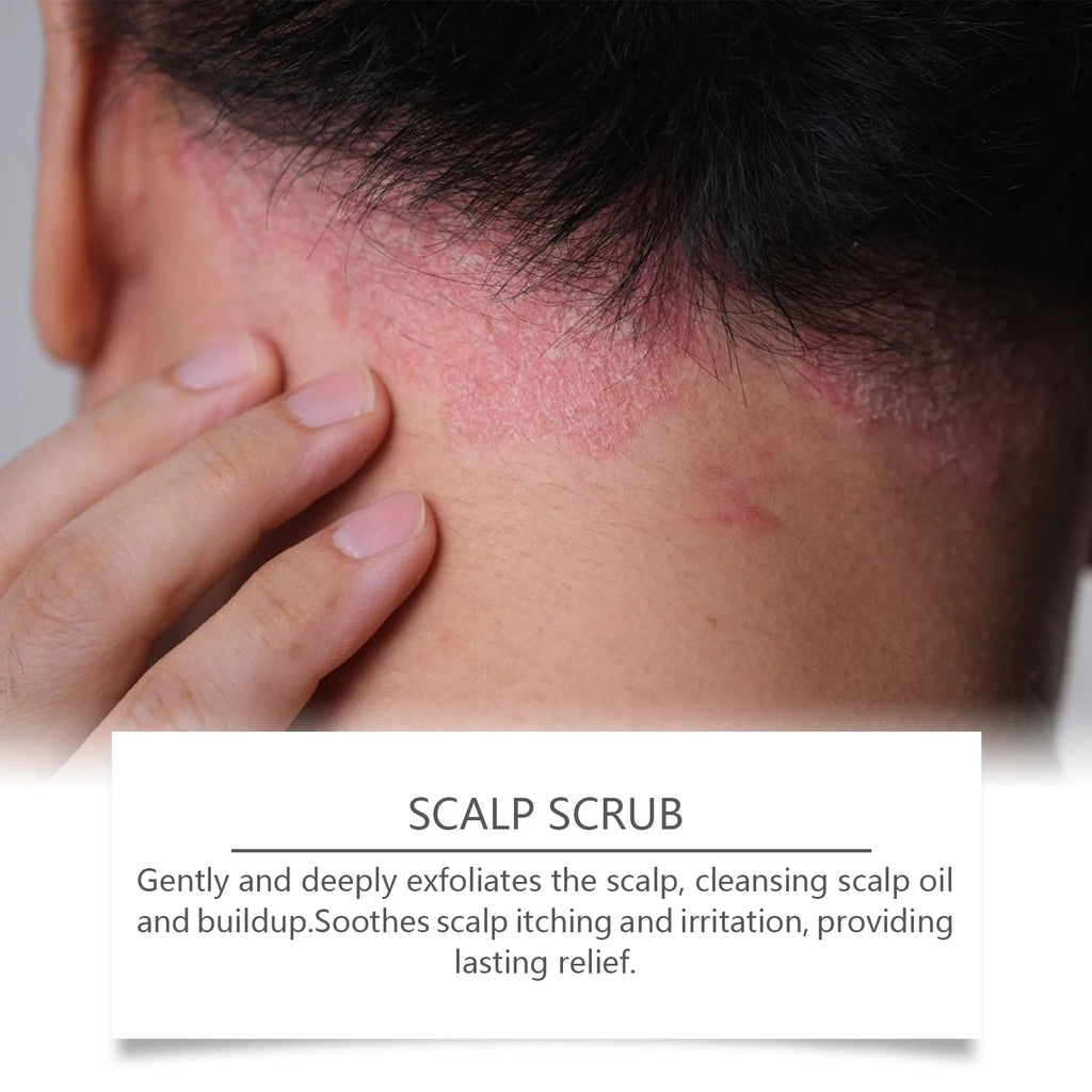 Deep Cleansing Scalp Exfoliating Scrub for Dandruff Relief