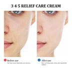Soothing Repair Facial Cream for Acne-Prone Skin