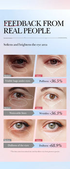 Retinol Anti-Aging Roll-On Eye Cream for Dark Circles