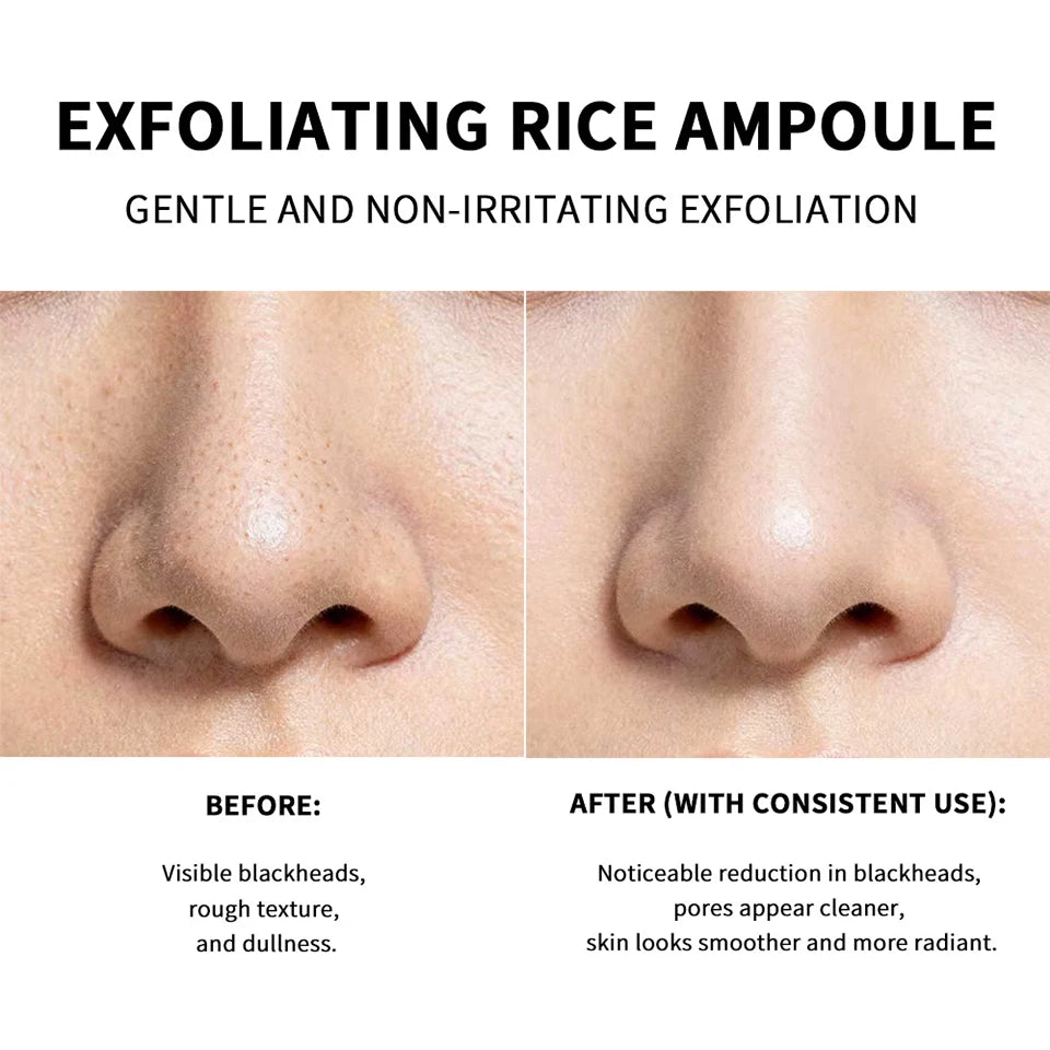 Exfoliating Rice Essence for Deep Pore Cleansing and Brightening