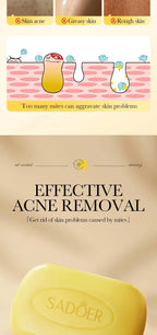 Sulfur Anti-Acne and Mite Removing Facial Soap