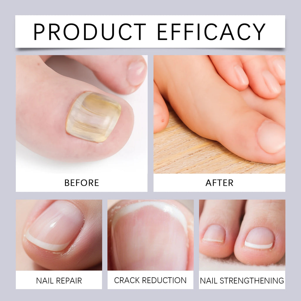Nourishing Nail Repair Essence Pen