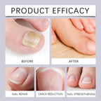 Nourishing Nail Repair Essence Pen