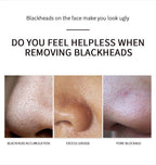 Deep Cleansing Nose Pore Strip and Blackhead Remover Kit