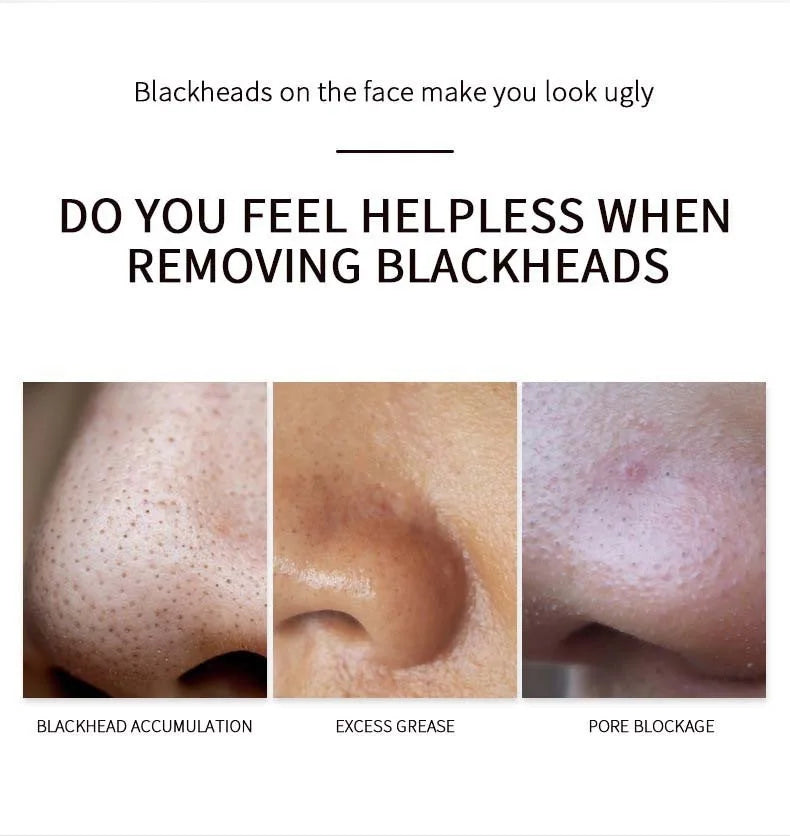 Deep Cleansing Nose Pore Strip and Blackhead Remover Kit