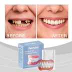 Temporary Cosmetic Dentures for Instant Smile Confidence