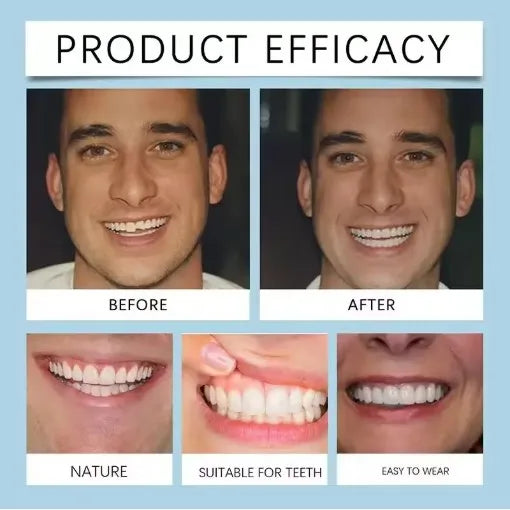 Flexible Cosmetic Denture Set for Natural Smile - 5