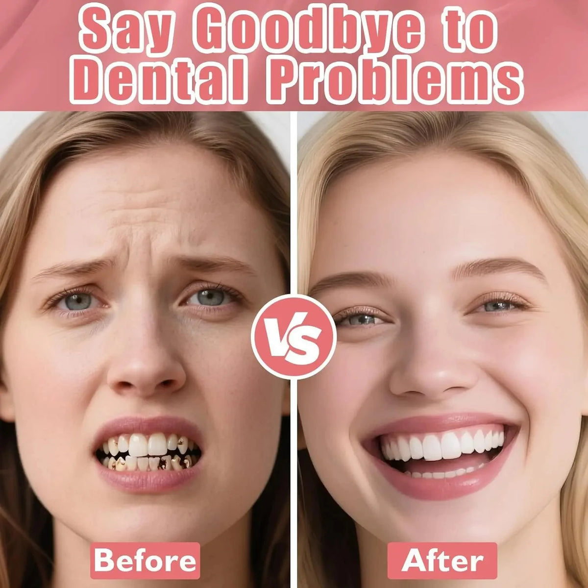 Realistic Natural Texture Cosmetic Denture Set