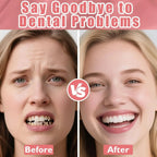 Realistic Natural Texture Cosmetic Denture Set