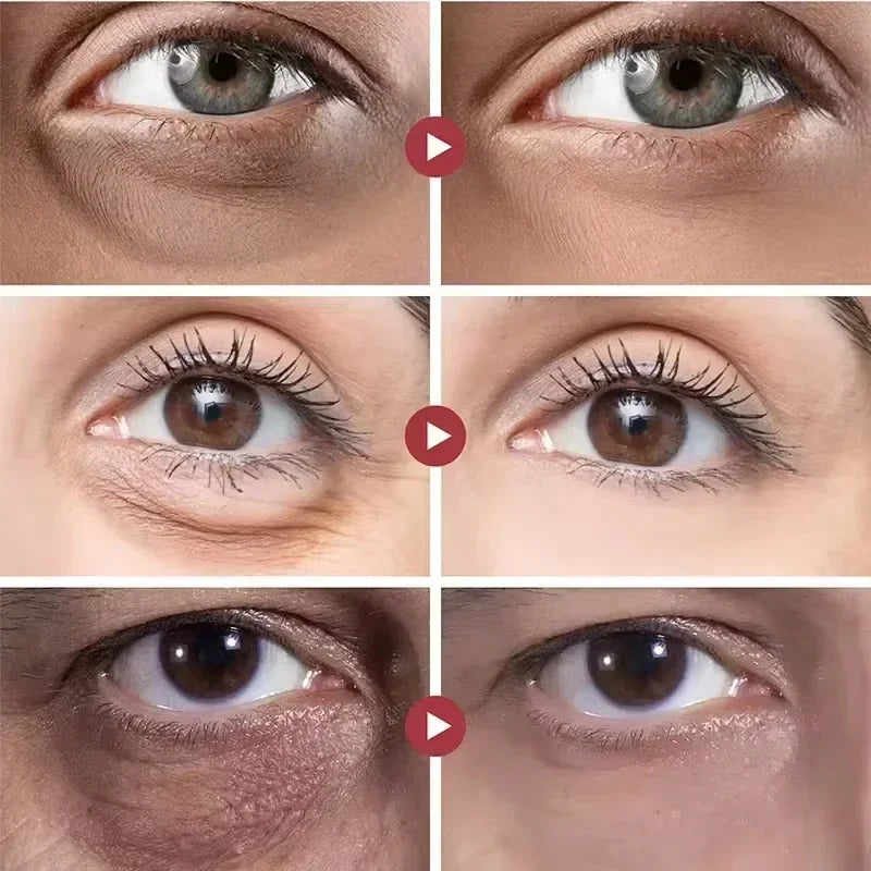 Retinol Anti-Aging Roll-On Eye Cream for Dark Circles