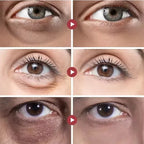 Retinol Anti-Aging Roll-On Eye Cream for Dark Circles