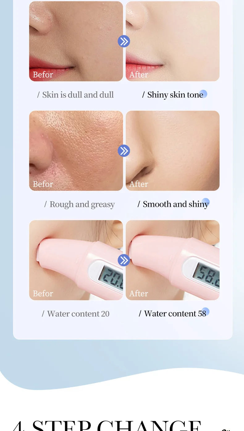 Hydrating Hyaluronic Acid Sheet Masks for Radiant Skin - 18