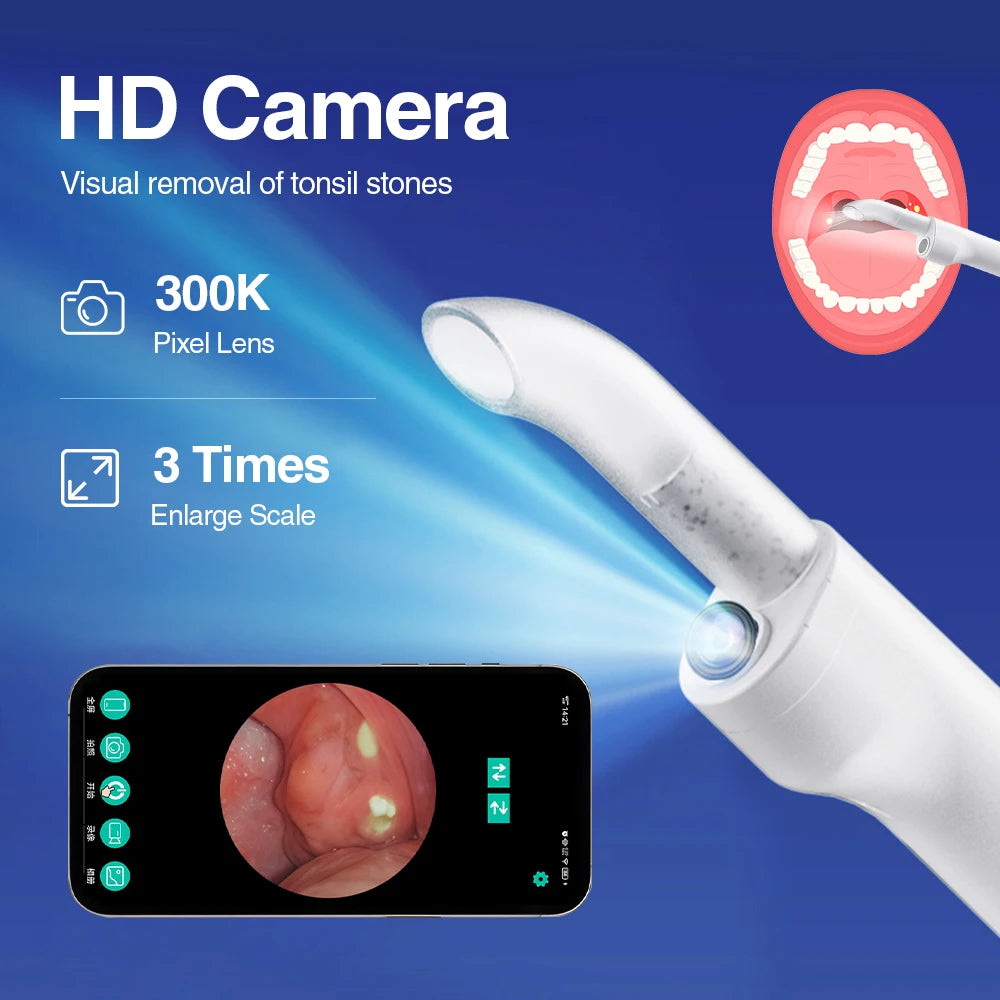 Visible Tonsil Stone Remover with HD Camera