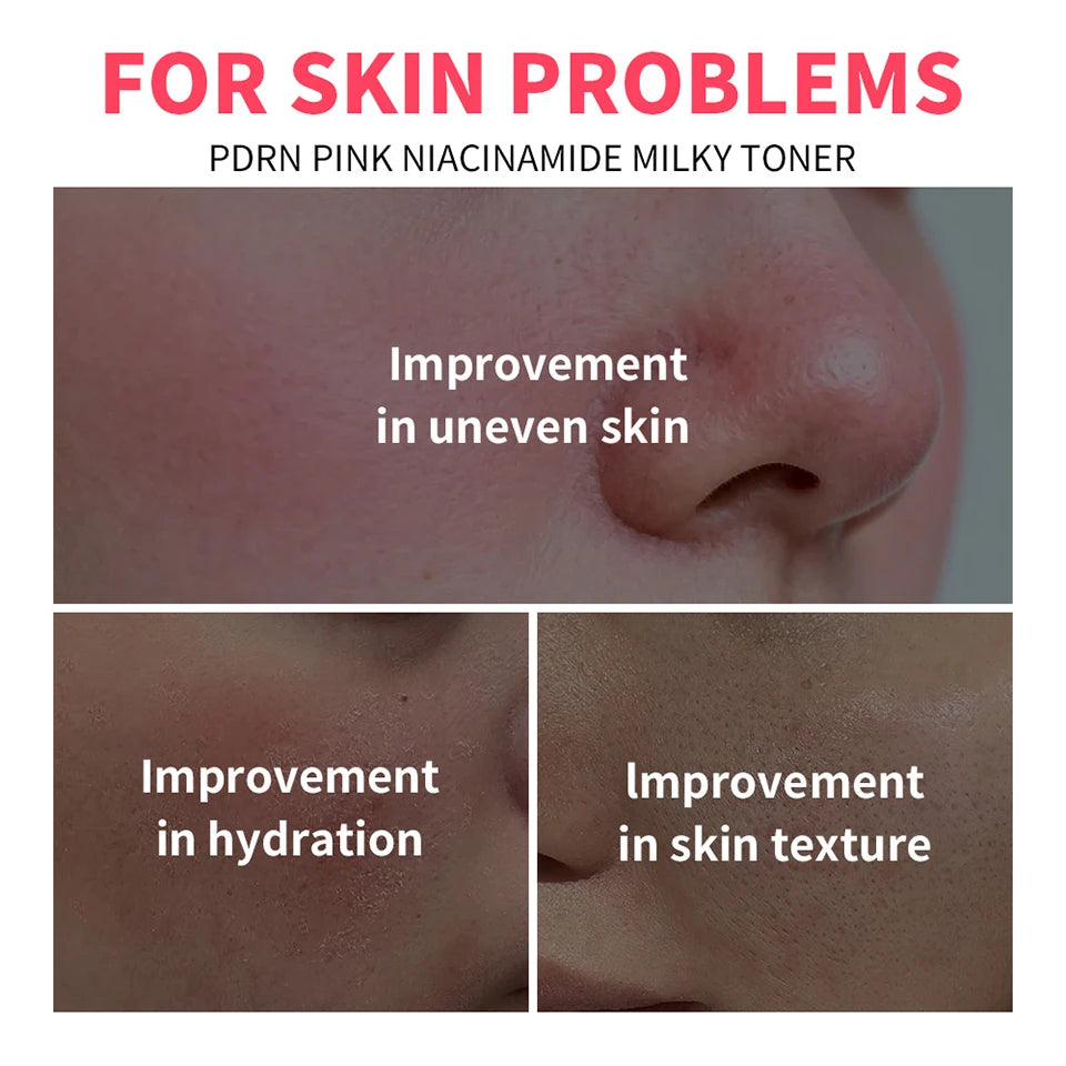 PDRN Niacinamide Milky Facial Toner for Glowing Hydrated Skin