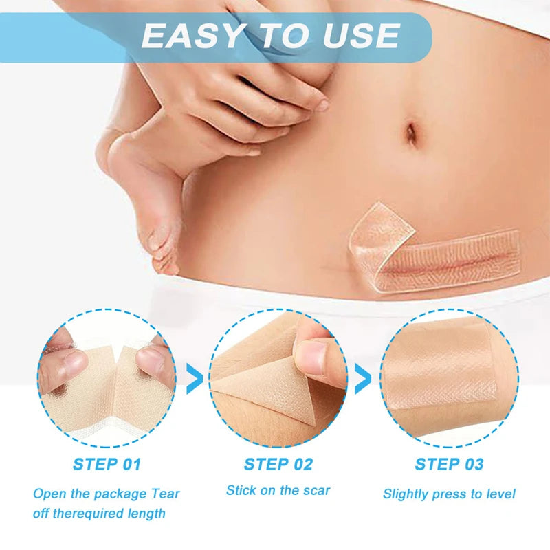 Silicone Scar Removal Tape for Effective Skin Healing - 2