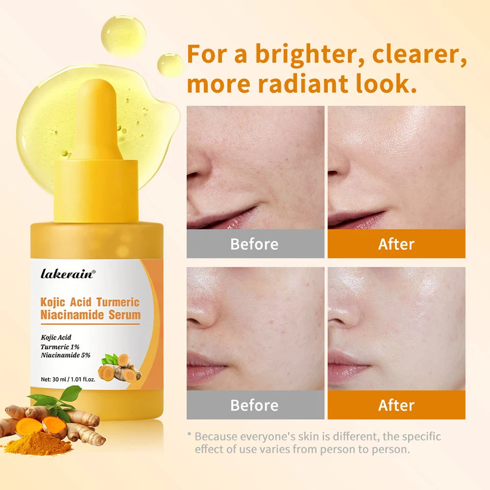 Brightening Kojic Acid & Turmeric Facial Serum - 11