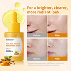 Brightening Kojic Acid & Turmeric Facial Serum