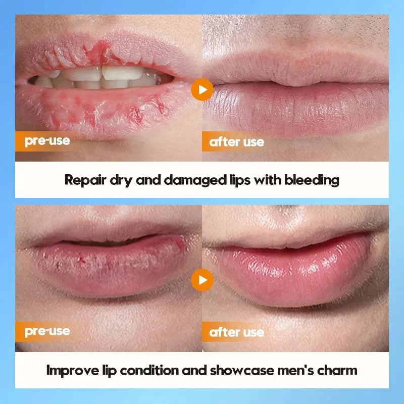 Moisturizing Lip Repair Balm for Men