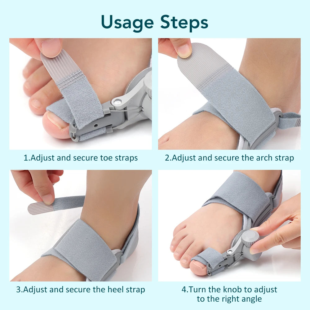 Adjustable Bunion Corrector for Pain Relief and Toe Alignment