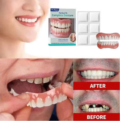 Comfort Fit Cosmetic Smile Veneers for Natural Looking Teeth