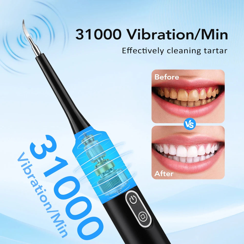 Electric Sonic Dental Scaler and Tartar Remover for Home Use