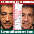 Retinol Anti-Aging Roll-On Eye Cream for Dark Circles