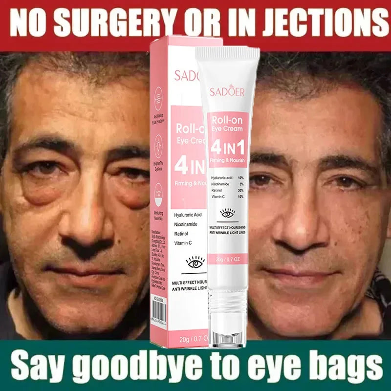 Retinol Anti-Aging Roll-On Eye Cream for Dark Circles