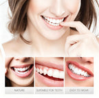 Instant Snap-On Cosmetic Teeth Veneers