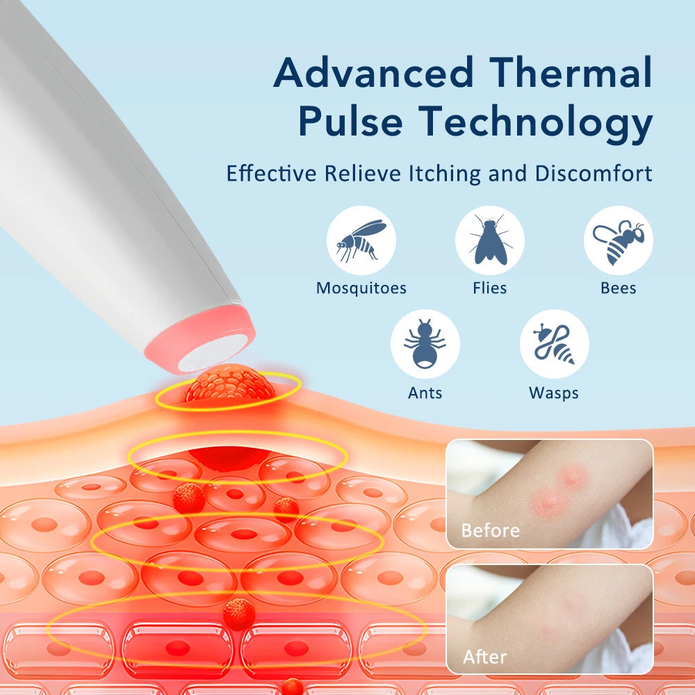 Electric Itch Relief Pen for Insect Bites