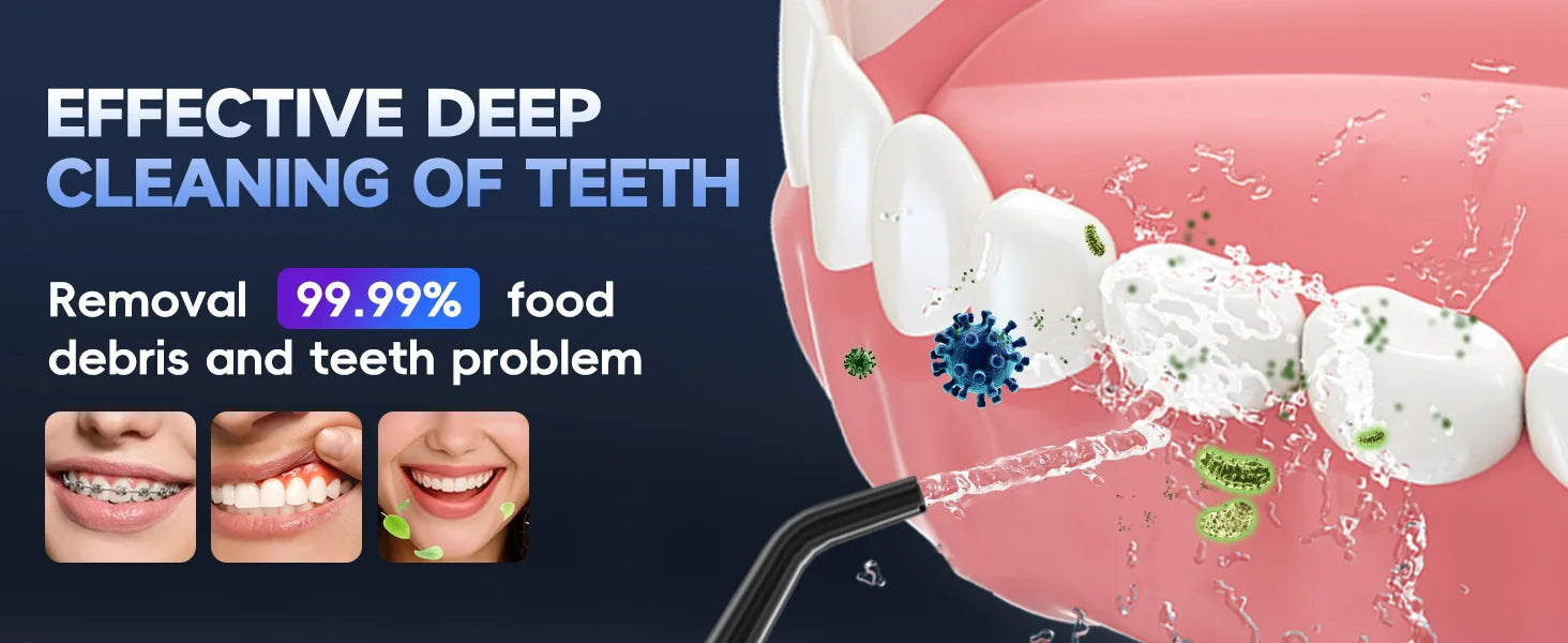 Cordless Water Flosser for Teeth Deep Cleaning - 12
