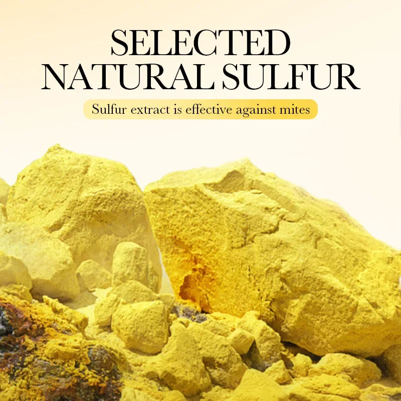 Sulfur Anti-Acne and Mite Removing Facial Soap - 3