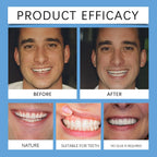 Adjustable Snap-On Cosmetic Dentures for Instant Perfect Smile